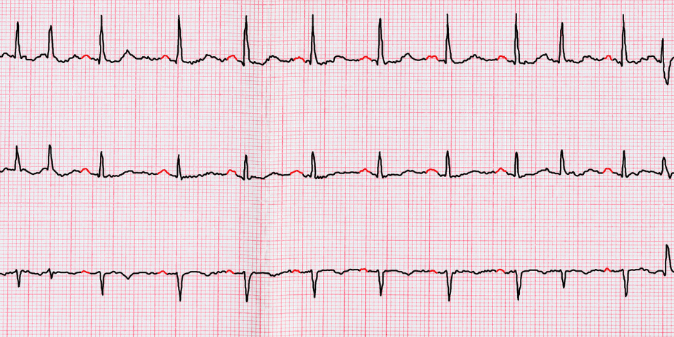 AF HealthPlan information